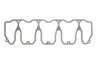 Garnitura, capac supape